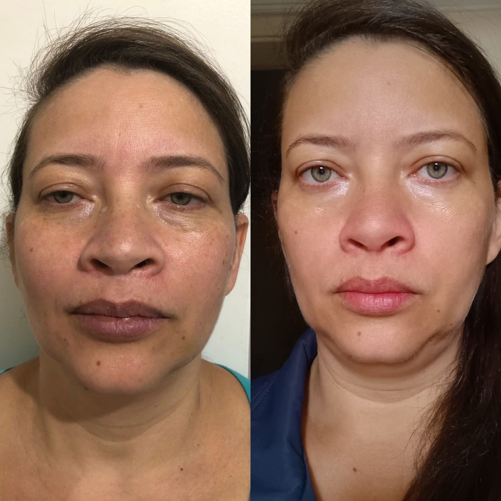 Transformação – Antes & Depois